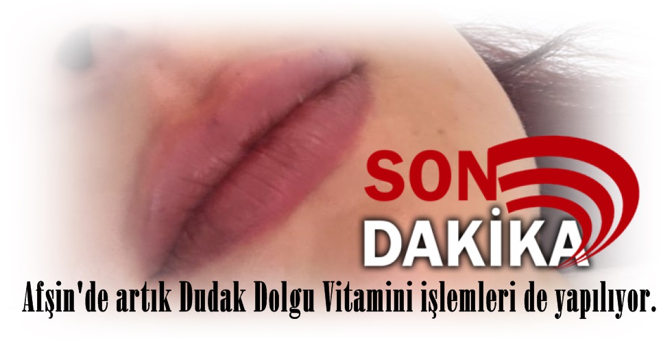 WhatsApp Image 2023-09-14 at 12.20.15 (1)YI